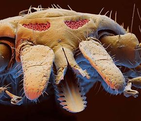 Голова иксодового клеща крупным планом. Хорошо видно, что хоботок клеща зазубрен (фото с сайта www.eyeofscience.de)