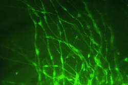 Светящиеся белки показывают, что из стволовых клеток сформировались нейроны (фото с сайта www.sciencentral.com)