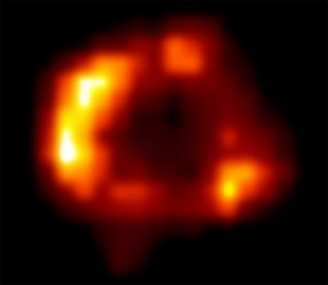 Взрыв сверхновой в 1987 году в Большом Магеллановом облаке, видимый невооруженным глазом, произошел на расстоянии 169 000 световых лет от Земли (снимок сделан рентгеновской обсерваторией Чандра; фото с сайта chandra.harvard.edu)
