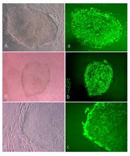 HESC-клетки под микроскопом (фото с сайта www.ncl.ac.uk)