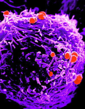 Гонококки на поверхности лимфоцита (фото с сайта neisseria.org)