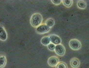Клетки дрожжей Saccharomyces (фото с сайта www-micro.msb.le.ac.uk)