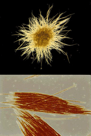 Колонии Trichodesmium разной формы. Вверху «пуховка» (puff), внизу — «пучок» (tuft). Нижняя фотография сделана под большим увеличением — видно, что нити (трихомы) состоят из отдельных клеток. Фото с сайтов microscope.mbl.edu и www.veda.cz
