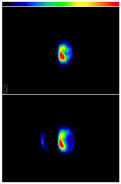 Система RS Змееносца через 21 (вверху) и 27 (внизу) суток после вспышки (фото с сайта www.cnews.ru)