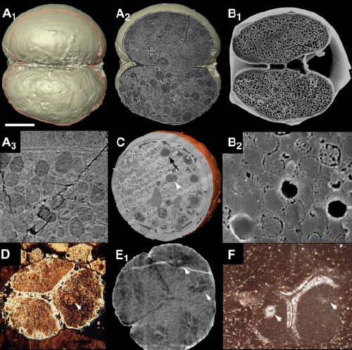 Вот так выглядят изнутри эмбрионы из Доушаньтуо. А — двухклеточный эмбрион. Розовой линией на А1 показана плоскость сканирования томографом, результат сканирования — это А2. Хорошо видны темные гранулы, включения желтка или липидов. Они увеличены для наглядности на А3. Для сравнения такие же липидные включения у двухклеточных эмбрионов морского ежа показаны на В1и В2. С — это эмбриональная клетка с включениями, некоторые из которых не повреждены, другие сплющены (белая стрелка), третьи — с разрушенной оболочкой (черная стрелка. Эмбрионы из четырех клеток — D, E и F — интересны тем, что в них видны включения второго типа: относительно крупные, с характерным показателем поглощения рентгеновских лучей, на Е1 стрелочки показывают симметричные включения в одной из клеток. Фото из статьи в Science