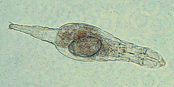 Бделлоидная коловратка Adineta ricciae (фото с сайта www.biot.cam.ac.uk)
