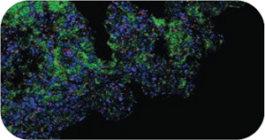 Масса клеток внутри губки, «размеченная» флуоресцентными белками. Зеленые — это клетки самой губки, синие — неопределенные симбионты, а красные — бактерия нитрификатор Nitrospira. Фото из статьи в Science