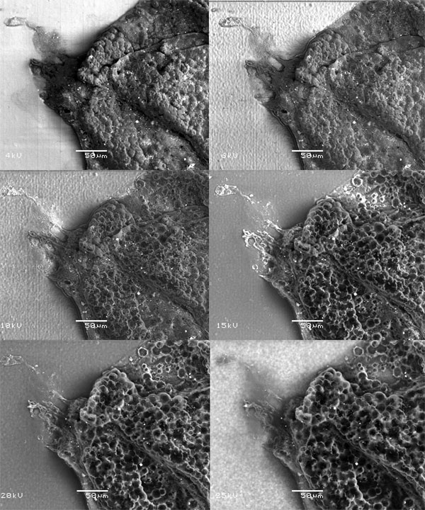 Рис. 2. В этом ряду фотографий электронный луч просвечивает оболочки сферы (3) на разную глубину, то есть слой за слоем постепенно проявляется внутреннее содержимое сферы: округлые камерки с темными спорами