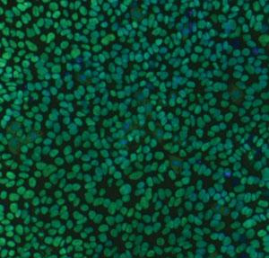 Индуцированные плюрипотентные клетки. Микрофотография из заметок Эшли Йейгера (Ashley Yeager) в журнале Nature о важнейших научных новостях 2008 года