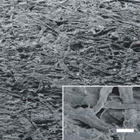Чернильное пятно, возникающее вследствие двухсекундного простоя перьевой авторучки