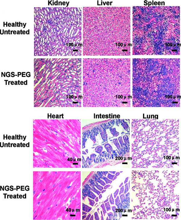 Сравнение срезов внутренних органов «графеновых» и «неграфеновых» мышей. Healthy untreated — здоровые неинъецированные мыши, NGS-PEG treated — мыши, получившие инъекцию графена. Kidney — почки, liver — печень, spleen — селезенка, heart — сердце, intestine — кишечник, lung — легкие. Изображение из обсуждаемой статьи в Nano Letters