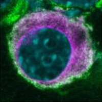 Стабильные включения белка в клетках, экспрессирующих OptoTau-ΔN