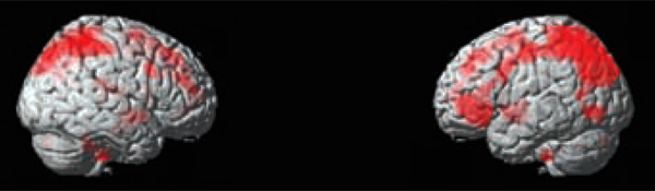 Участки коры, в которых у матерей увеличивается объем серого вещества. Изображение из обсуждаемой статьи в Behavioral Neuroscience