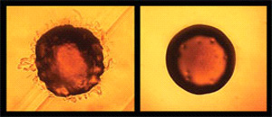 Обычный вид бактерии Pseudomonas aeruginosa (слева) и она же после тридцатипятилетней эволюции в условиях больницы (справа). Фото с сайта www.pnas.org