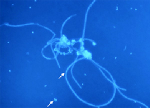 Бактерии из одной из скважин, где было найдено два вида нематод. Бактерии представлены разными морфотипами: филаменты, палочки и кокки. Фото из дополнительных материалов к обсуждаемой статье в Nature