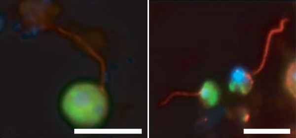 Рис. 1. Клетки новооткрытых существ — криптомицетов. Зеленым цветом окрашена рибосомная РНК криптомицетов (при помощи метода TSA-FISH), красным — их жгутики (использовались антитела к тубулину — главному белку жгутиков эукариот). Длина масштабной линейки — 10 микрометров. Изображение из обсуждаемой статьи в Nature