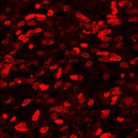 Активация нейронов способствует увеличению темпов роста опухоли