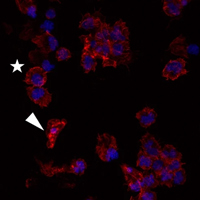 Гемоциты больных моллюсков