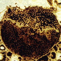 Рис. 1. Ископаемые эмбрионы на стадии Megaclonophycus