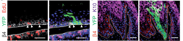 Динамика развития папиллом