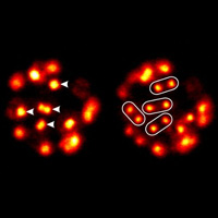 На грани перехода к многоклеточности: представитель мезомицетозоев Sphaeroforma arctica. Сфероформа очень близка к креолимаксу, о котором идет речь в статье