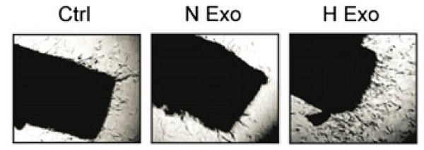 Рис. 3. Рост новых сосудов, ответвляющихся от фрагментов мышиной аорты, не инкубировавшейся с экзосомами (Ctrl), инкубировавшейся с экзосомами из клеток глиобластомы, нормально снабжавшихся кислородом (N Exo), и инкубировшейся с экзосомами из клеток, страдавших от гипоксии (H Exo).