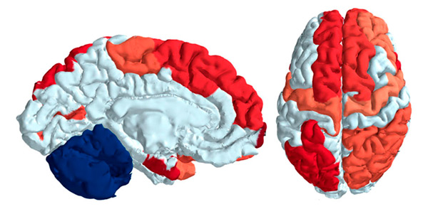 Области, в которых модульная организация коннектома выражена лучше, чем у противоположного пола