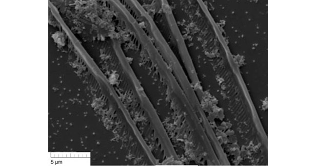 Рис. 3. Фильтровальная гребенка на антеннах науплиусов Artemia