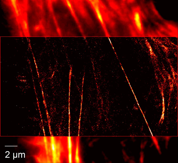 Рис. 4. Изображение актинового цитоскелета живой клетки