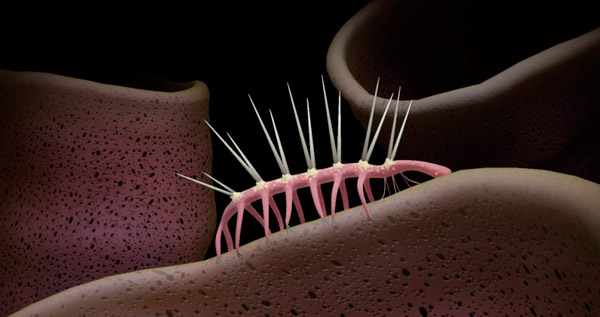 Рис. 1. Трехмерная реконструкция галлюцигении
