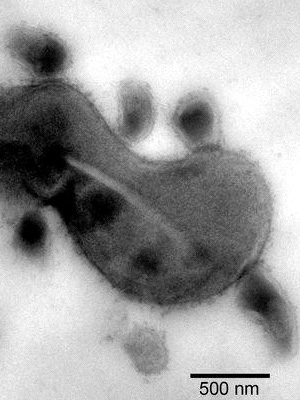 Так выглядит бактерия ТМ7 (небольшие круглые клетки) — паразит, живущий на клетках актиномицета; в лабораторной культуре ТМ7 можно вырастить только в компании с актиномицетом