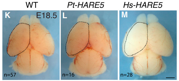Рис. 3. Мозг эмбрионов мыши с разными вариантами HARE5