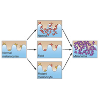 Схема возможных путей возникновения меланомы