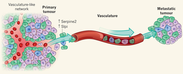 Рис. 3. Сеть «псевдососудов» в опухоли как драйвер метастазирования