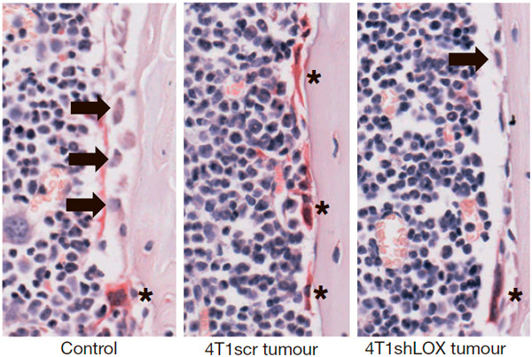 Рис. 3. Секретируемая опухолью LOX модулирует соотношение остеокластов и остеобластов