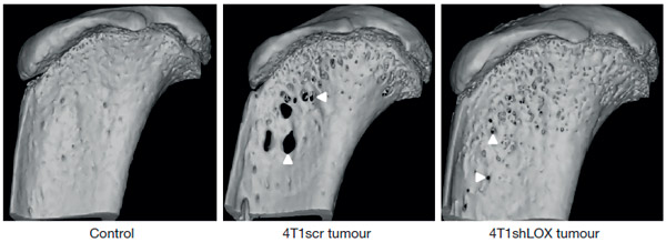 Рис. 1. Формирование остеолитических полостей в костях мыши зависит от лизилоксидазы