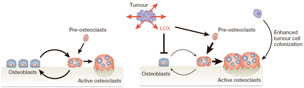 Рис. 2. Схема нарушения гомеостаза костной ткани лизилоксидазой и последующее формирование метастазов