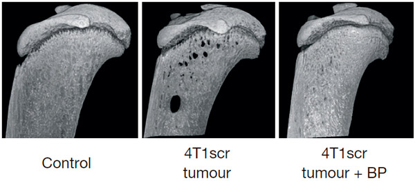 Рис. 5. Подавление формирования полостей бифосфонатом золедроновой кислоты