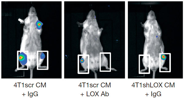 Рис. 4. Образовавшиеся в результате усиленной экспрессии LOX полости в костях колонизируются опухолевыми клетками