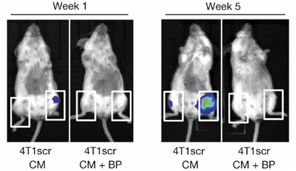 Рис. 6. Бифосфонат золендроновой кислоты, подавляя образование LOX-индуцированных полостей, предотвращает формирование метастазов