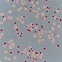 Колонии Escherichia coli в чашке Петрина среде из агара, содержащего арабинозу