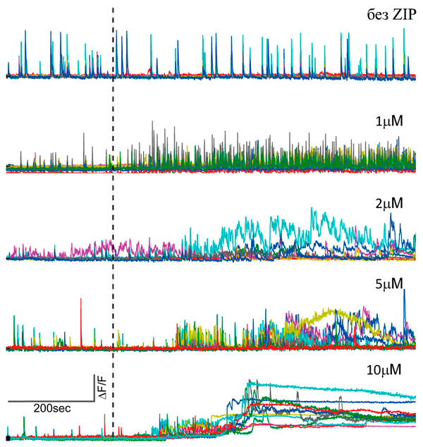 Рис. 1. Добавление ZIP в среду клеток гиппокампа повышает электрическую активность последних