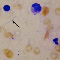 Боррелии (Borrelia)