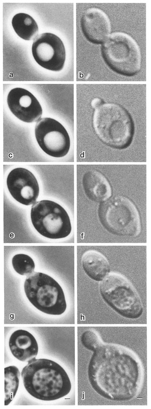 Накопление аутофагосом внутри вакуоли в дрожжевой клетке