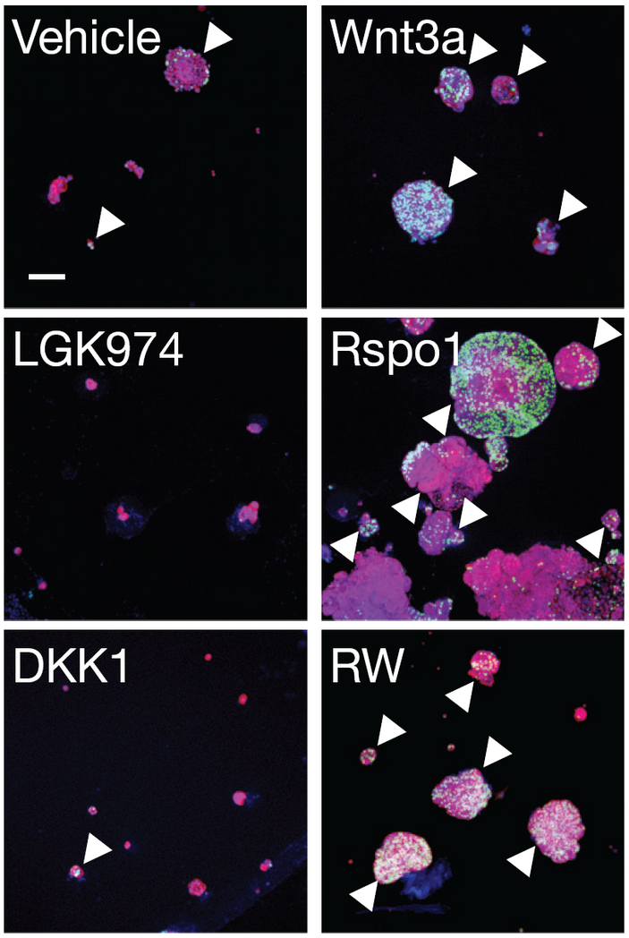 <b>Рис. 2.</b> Рост клеток аденокарциномы легких стимулируется лиганд-зависимым сигнальным путем Wnt