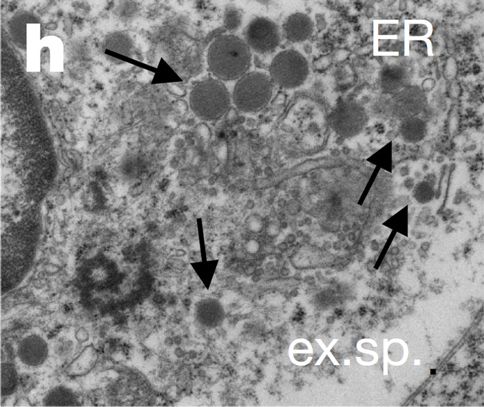 Рис. 2. Секреторные гранулы фолликулярных Т-хелперов