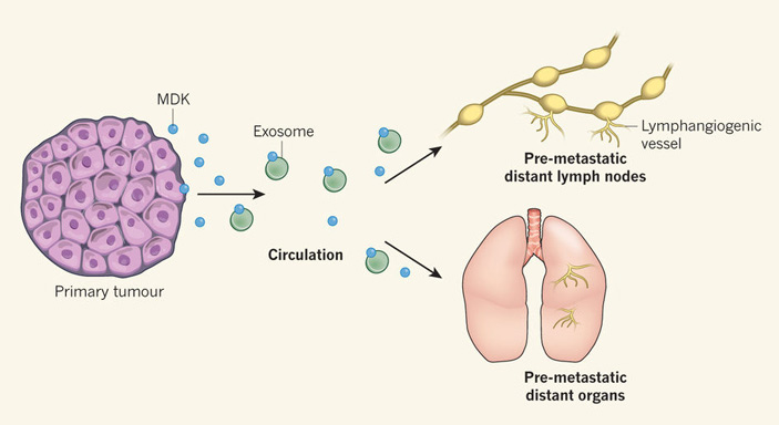 Общая схема пути, по которому меланома формирует метастазы