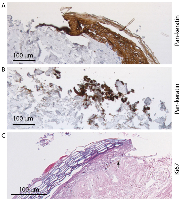 Рис. 4. Заживление раны на человеческой коже, содержащейся в виде дисков на питательной среде