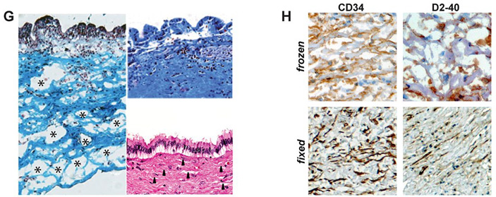 Рис. 2. Сравнение замороженных и фиксированных тканей желчных протоков