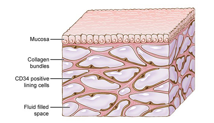Рис. 4. Схематическое изображение открытой губчатой структуры
